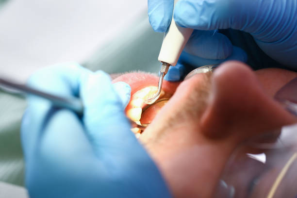 Best Broken or Cracked Tooth Emergency Dentist in Dix Hills, NY